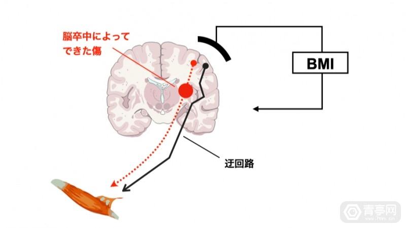 脑机接口|日本BMI脑机接口公司LIFESCAPES获7.2亿日元融资