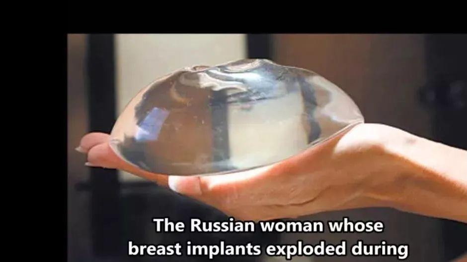 隆胸|越南女演员花1万元隆胸，结果坐飞机时胸炸了...