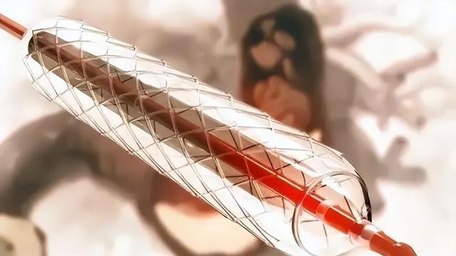 700元心脏支架“涨”回5万，医代解释：700元的不好用