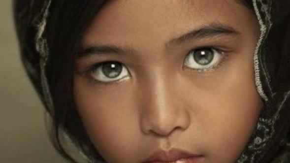 人可能有三只眼睛吗？印度小女孩的第三只眼，连科学家也无法解释