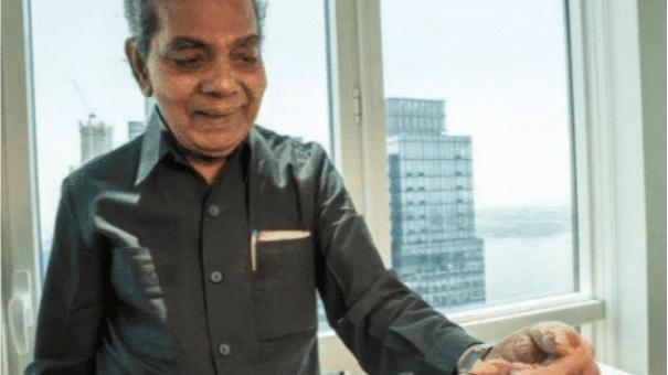 印度男子留66年长指甲，创吉尼斯记录，锯掉后“手”已致残
