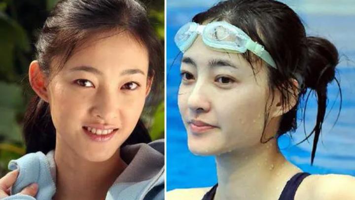 明星|有明星割双眼皮从猪头男变男神，也有人把自己整成“悲伤蛙”