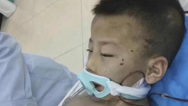 陕西6岁小男孩被继母打成了植物人，继母被判16年，今年男孩已离世
