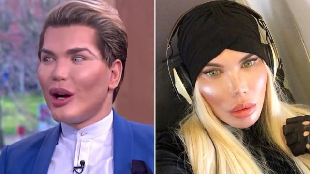 整容|巴西少年想整容42次变“芭比男友”，没办法火起来改行跑去搬砖了