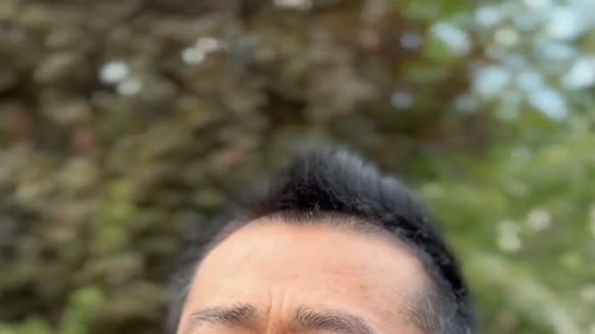 李嘉明|演员李嘉明现身医院看病！劳累过度颈椎病复发，疼到失眠双眼发红