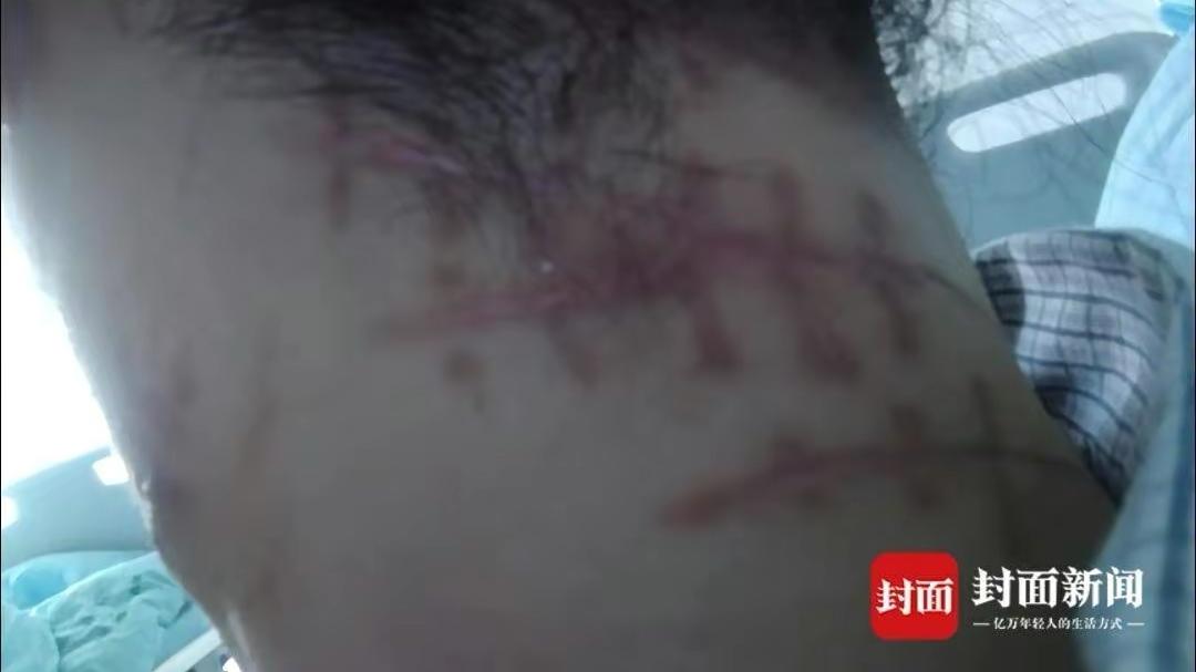 广东惠州，女子被入室抢劫时，身中16刀装死逃过一劫