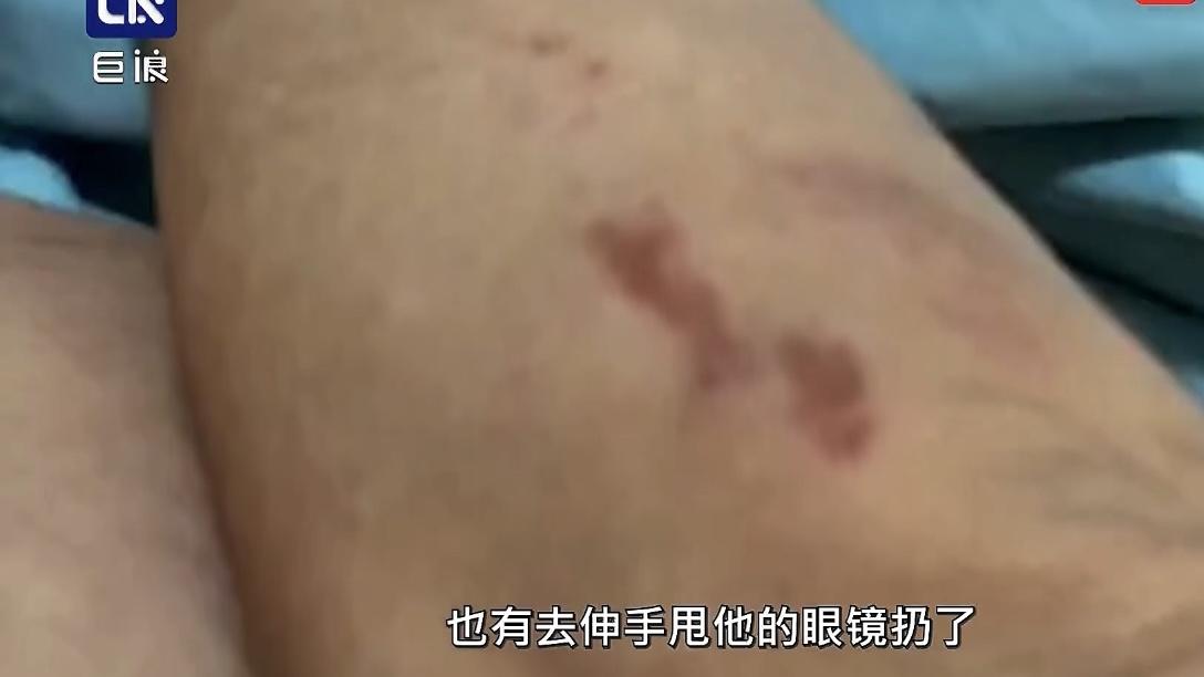 浙江台州，KTV女服务员因拒绝喝下1箱半啤酒被客人殴打