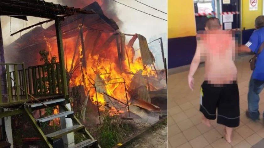 房屋起火智障男却拒绝逃离 弟弟冲入火场救人双双被烧伤