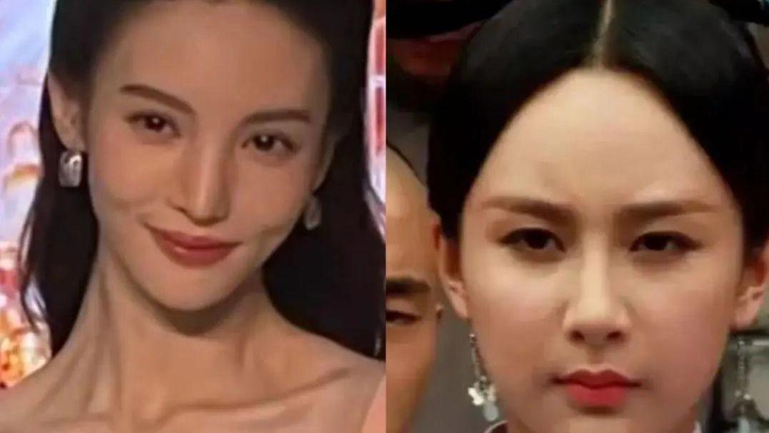 伊能静 强行扮嫩、动脸成瘾、为减肥切胃洗肠，女星的畸形审美好恐怖