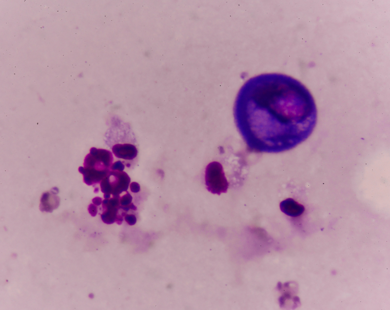 人参|山药搭配“一酸”,睡前坚持一杯,hpv慢慢消失不见