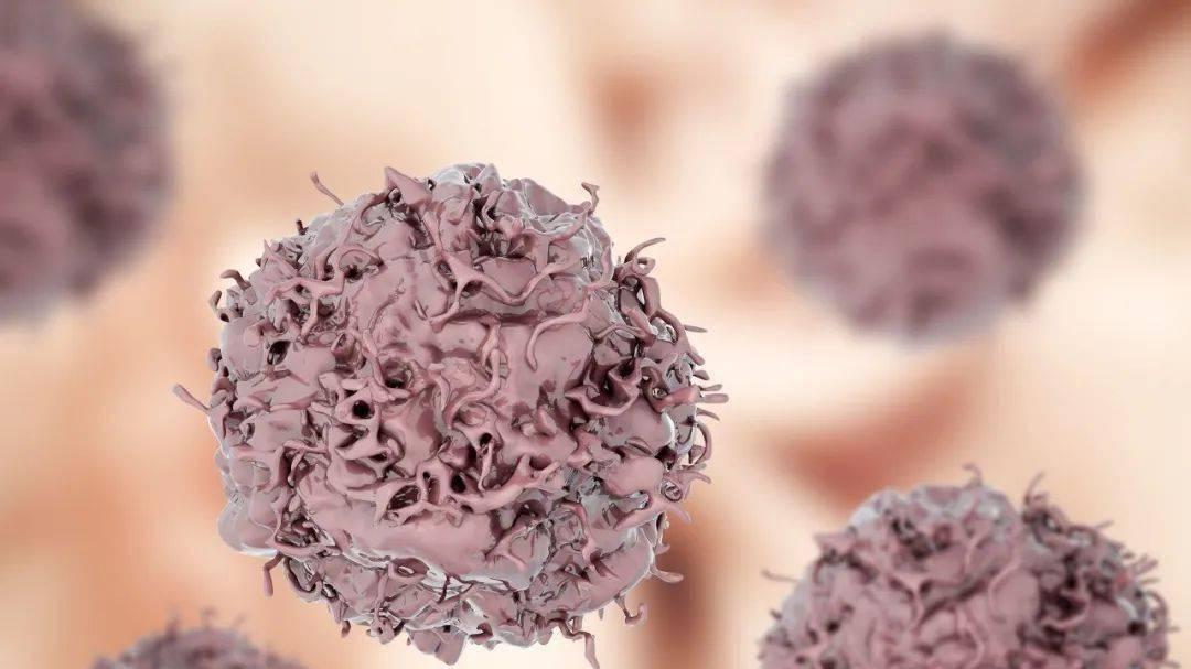 让癌细胞自己饿死自己，科学家找到肿瘤新方法