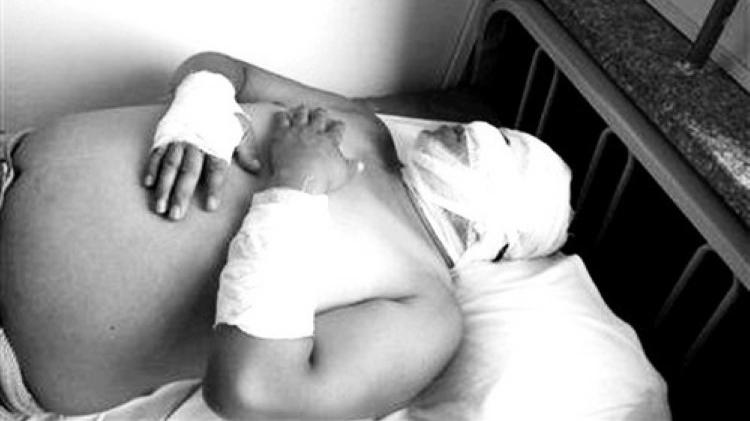 2012年东北一只金雕，连续袭击同一人致重伤住院，受害人却被判刑