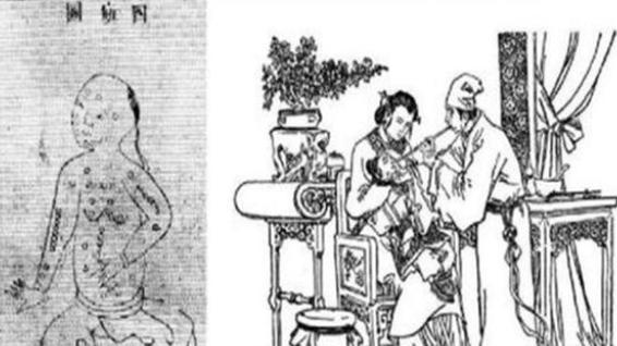 人类唯一战胜过的病毒，肆虐3000多年的天花病毒是怎么被击败的？