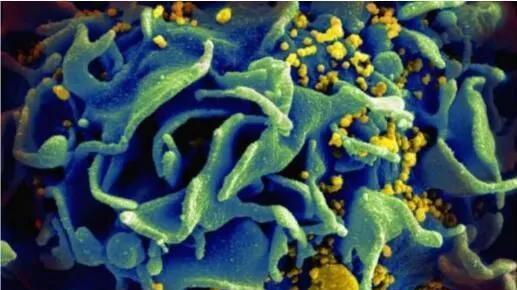 Science子刊：HIV的清除性治愈可能隐藏着终结艾滋病的秘密