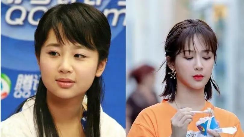 整容|这五位女星，动脸太成功，动成了颜值巅峰！