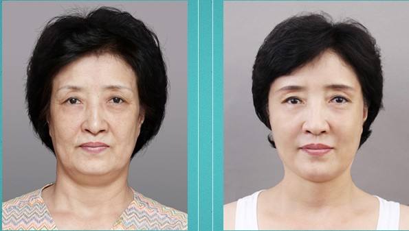 姐姐|继“百雀羚”后，中国又一“平价”护肤品走红！高质低价