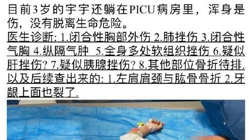 又反转？3岁幼儿被8岁恶童从17楼推下有大内幕？真凶让人意外...