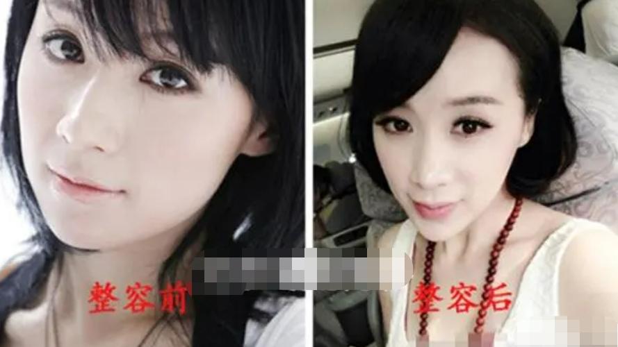 整容|“国民媳妇”姚芊羽：因整容隐退幕后，把路越走越窄