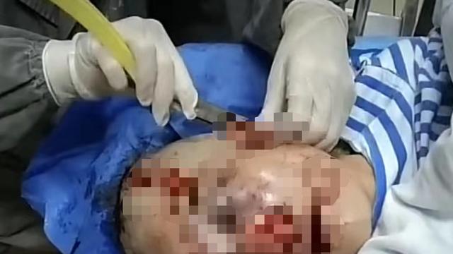 女子在公共厕所被殴打致脸部毁容？浙江警方：已将嫌疑人抓获归案！