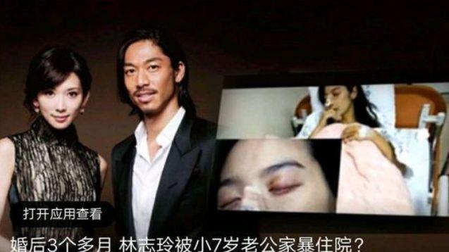 林志玲|林志玲首谈离婚，自曝患抑郁：结婚才3年，她怎么成这样了？