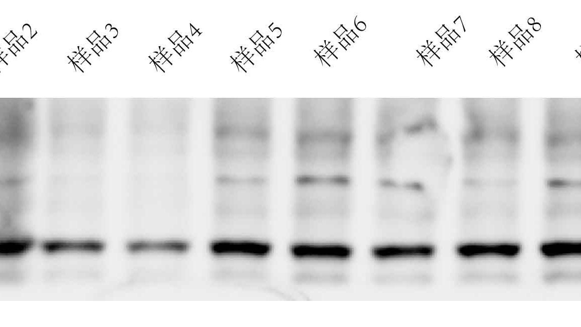 WB蛋白质印迹法(Western blot)