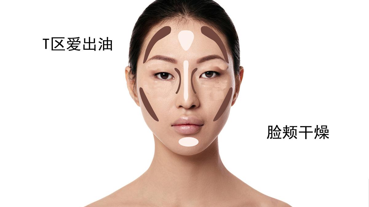 T区油的混油皮有什么特点，怎么护理？