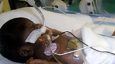 16年前，美国真实版拇指姑娘，出生时仅25厘米，后来怎么样了