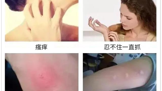 多数人不知蚊子怕啥？教你一个小窍门，开窗都不怕，整夜安睡