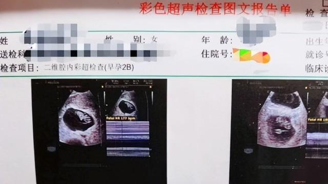 陈萌|陈萌晒孕8周产检单，直言对小伟的爱不是一时兴起，时间可以证明