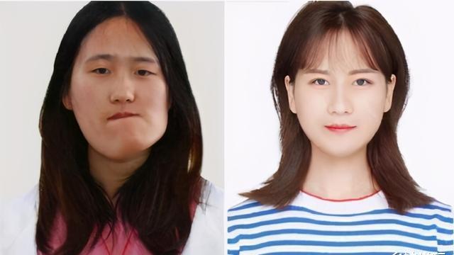 整容|“歪脸女孩”赵宏秋：舍百万年薪当老师，这才是整容的真正意义