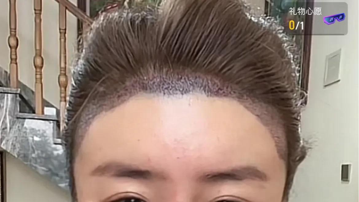 女网红花2万植发失败，坚持开播卖茶叶，继续和网友互怼！