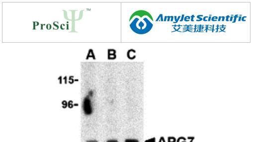 凋亡抗体研究丨ProSci自噬蛋白检测套装