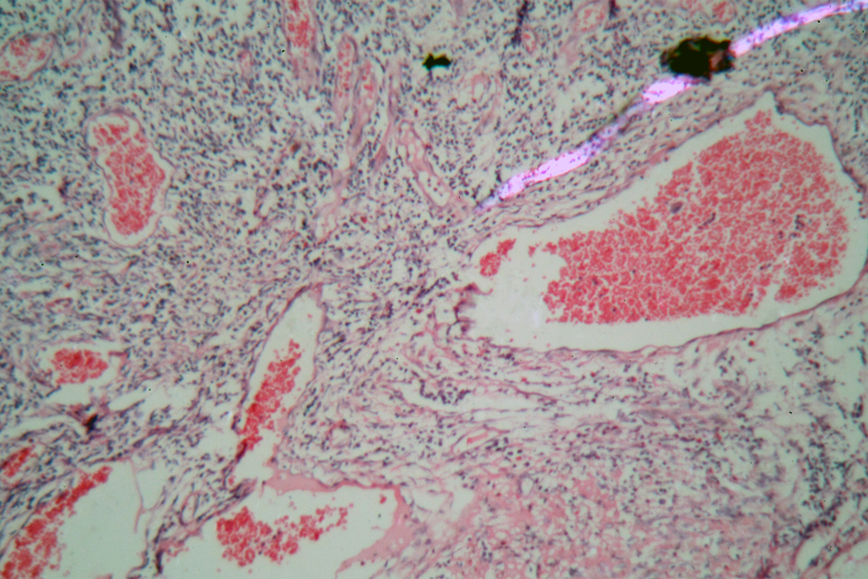 脾胃|2种食物堪称天然“转阴剂”,医生:日常三餐吃一点,hpv“溜得快”