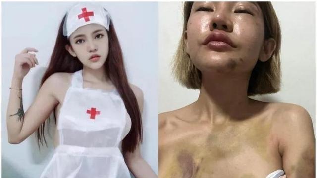 泰国网红遭受男友家暴，为爱隐忍数次后终于爆发