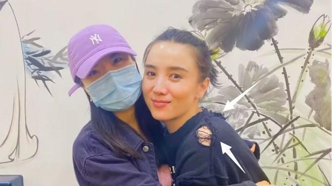 宋佳|41岁宋佳吃饭被偶遇，与粉丝拥抱好亲民，本人被赞又高又瘦