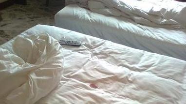 |住酒店，把床单弄上血渍，需要赔偿吗？