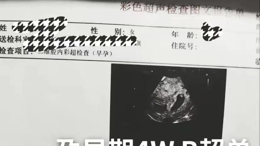 陈萌|大衣哥儿子朱小伟办婚礼，陈萌穿中式婚服，拿捧花遮挡小腹疑怀孕