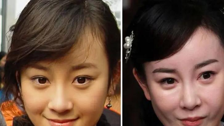 整容|“为爱整容”的张檬，塑料感满满，她都整了哪里呢？