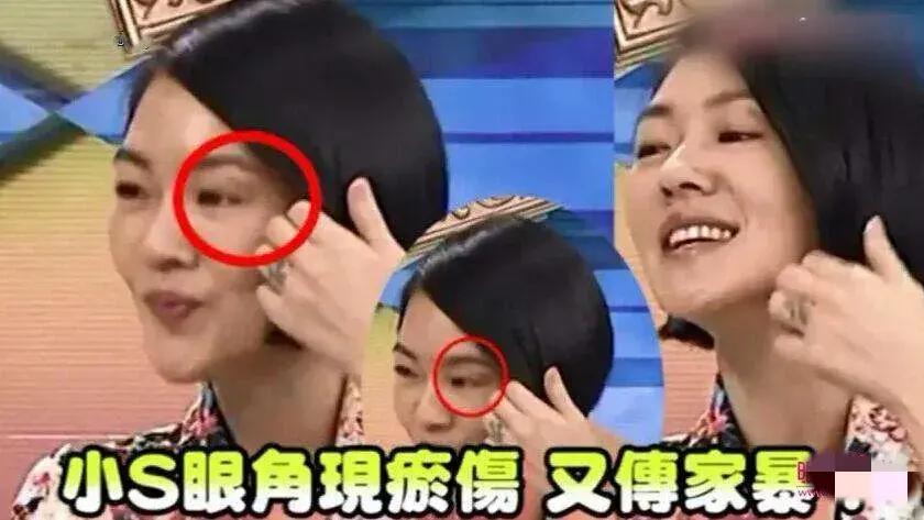 小S|曝小S出轨舞蹈老师？被老公发现后用钱摆平！