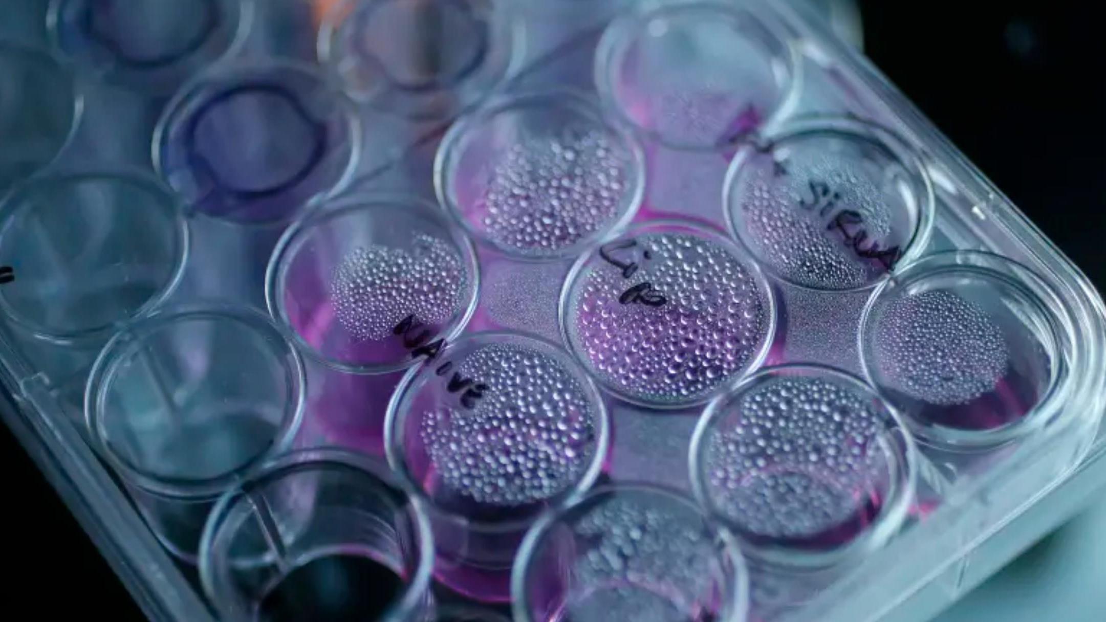 以色列科学家发现了癌细胞的致命弱点