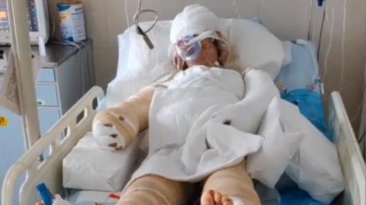 河南一小伙瞒着父亲“割皮救父”：只要俺爸有一口气，我都得救