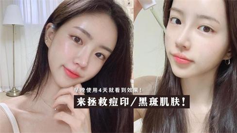面膜 多年老痘印 2个月就搞定 真正有效修复痘印痘痕的护肤品推荐