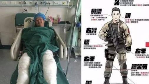 赵丽颖|拍戏意外受伤不卖惨：吴京全身缝100多针，赵丽颖后背凸起