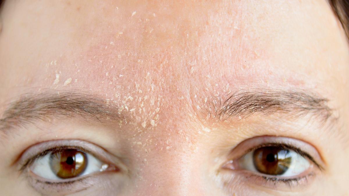 补水 你的肌肤缺水吗？肌肤缺水危害大，一定要会补水！