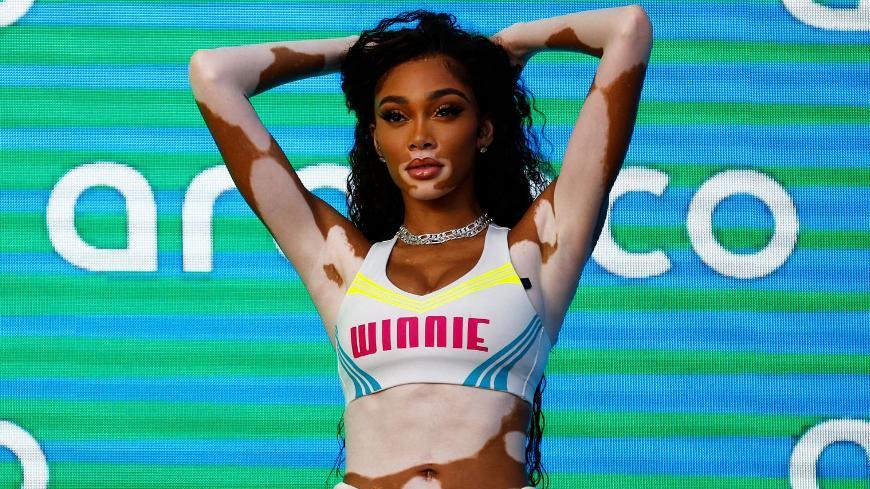 温妮·哈洛|库兹马女友晒近照！扮成埃及艳后，整片小腹全是白斑，另类花魁