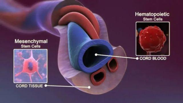 间充质干细胞首次成功应用重度肺动脉高压