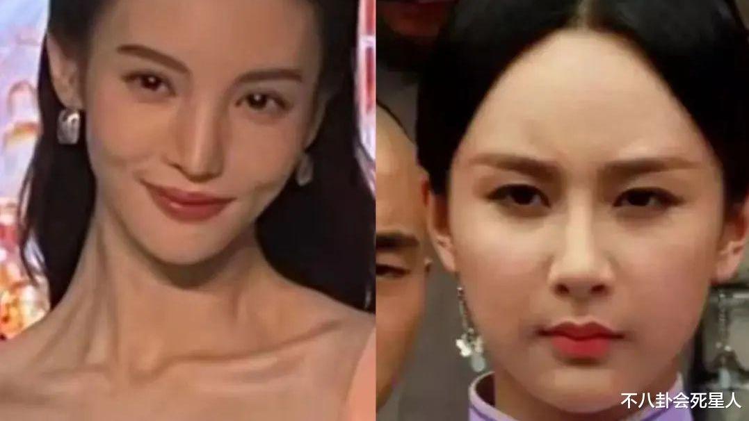 发际线 强行扮嫩、动脸成瘾、为减肥切胃洗肠，女星的畸形审美真恐怖