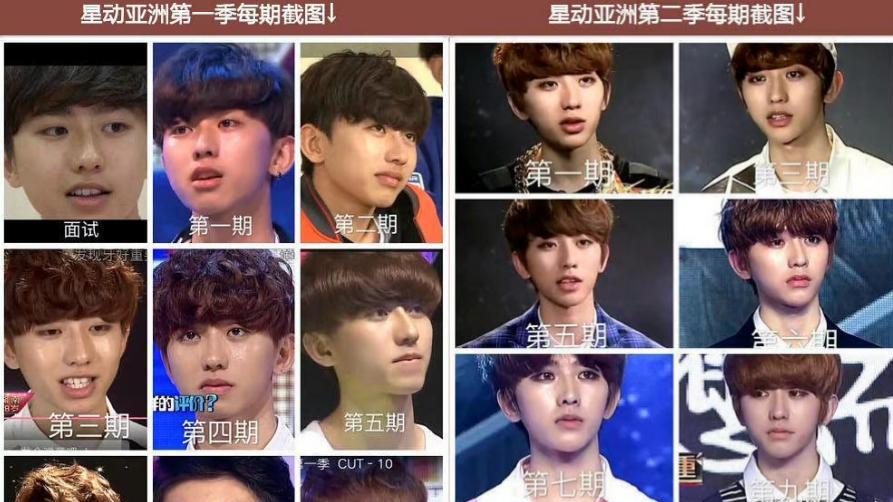 整容|蔡徐坤被曝整容，前经纪公司晒费用明细被打脸，网友：我给你两倍