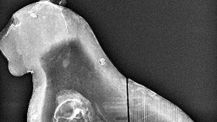 换个角度看世界：25张X射线下的罕见照片