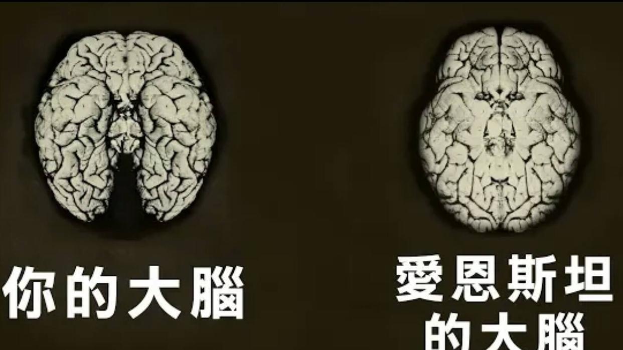 爱因斯坦死前说了两句话，护士没听懂，他死后大脑被切成240片